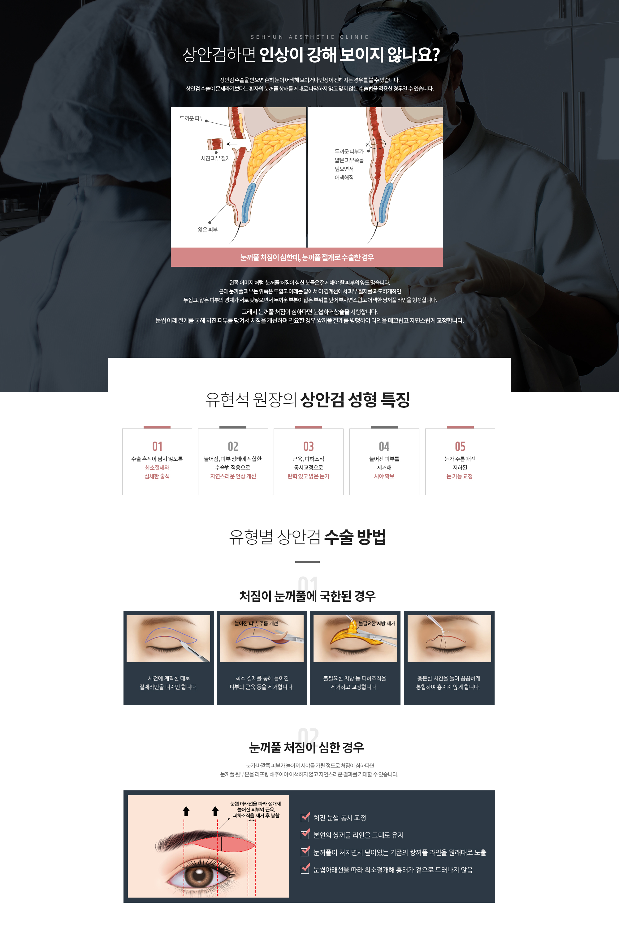 상안검하면 인상이 강해 보이지 않나요? 
		상안검 수술을 받으면 흔히 눈이 어색해 보이거나 인상이 진해지는 경우를 볼 수 있습니다. 상안검 수술이 문제라기보다는 환자의 눈꺼풀 상태를 제대로 파악하지 않고 맞지 않는 수술법을 적용한 경우일 수 있습니다. 

		왼쪽 이미지 처럼  눈꺼풀 처짐이 심한 분들은 절제해야 할 피부의 양도 많습니다. 
		근데 눈꺼풀 피부는 위쪽은 두껍고 아래는 얇아서 이 경계선에서 피부 절제를 과도하게하면
		 두껍고, 얇은 피부의 경계가 서로 맞닿으면서 두꺼운 부분이 얇은 부위를 덮어 
		부자연스럽고 어색한 쌍꺼풀 라인을 형성합니다. 

		그래서 눈꺼풀 처짐이 심하다면 눈썹하거상술을 시행합니다. 
		눈썹 아래 절개를 통해 처진 피부를 당겨서 처짐을 개선하며 
		필요한 경우 쌍꺼풀 절개를 병행하여 라인을 매끄럽고 자연스럽게 교정합니다. 

		유현석 원장의 상안검 성형 특징 
		수술 흔적이 남지 않도록 최소절제와 섬세한 술식
		늘어짐, 피부 상태에 적합한 수술법 적용으로 자연스러운 인상 개선
		근육, 피하조직 동시교정으로 탄력 있고 밝은 눈가
		늘어진 피부를 제거해 시야 확보
		눈가 주름 개선 저하된 눈 기능 교정

		유형별 상안검 수술 방법
		1. 처짐이 눈꺼풀에 국한된 경우
		사전에 계획한 데로 절제라인을 디자인 합니다. 
		최소 절제를 통해 늘어진 피부와 근육 등을 제거합니다. 
		불필요한 지방 등 피하조직을 제거하고 교정합니다. 
		충분한 시간을 들여 꼼꼼하게 봉합하여 흉지지 않게 합니다.
		
		2. 눈꺼풀 처짐이 심한 경우 
		눈가 바깥쪽 피부가 늘어져 시야를 가릴 정도로 처짐이 심하다면 눈꺼풀 윗부분을 리프팅 해주어야 어색하지 않고 자연스러운 결과를 기대할 수 있습니다.  
		처진 눈썹 동시 교정
		본연의 쌍꺼풀 라인을 그대로 유지
		눈꺼풀이 처지면서 덮여있는 기존의 쌍꺼풀 라인을 원래대로 노출
		눈썹아래선을 따라 최소절개해 흉터가 겉으로 드러나지 않음