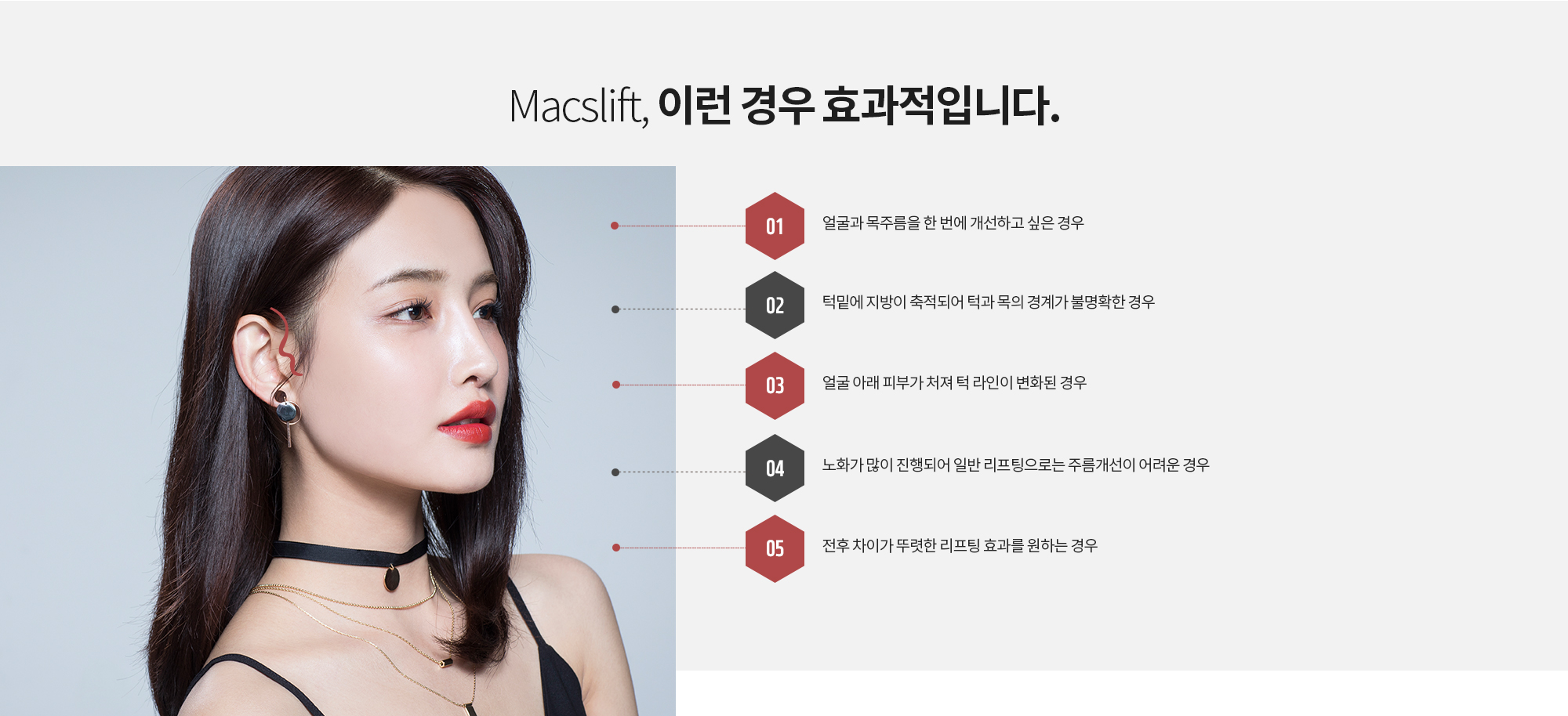 Macslift, 이런 경우 효과적입니다.
		얼굴과 목주름을 한 번에 개선하고 싶은 경우
		턱밑에 지방이 축적되어 턱과 목의 경계가 불명확한 경우
		얼굴 아래 피부가 처져 턱 라인이 변화된 경우 
		노화가 많이 진행되어 일반 리프팅으로는 주름개선이 어려운 경우
		전후 차이가 뚜렷한 리프팅 효과를 원하는 경우
