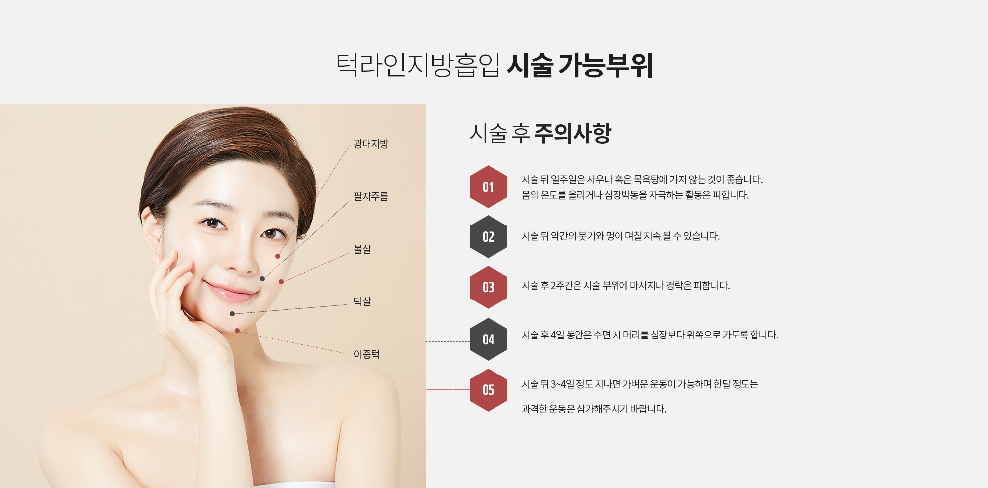 턱라인 지방흡입 시술 가능부위
		광대지방 
		팔자주름 
		볼살
		턱살
		이중턱 		
		
		시술 후 주의사항
		1. 시술 뒤 일주일은 사우나 혹은 목욕탕에 가지 않는 것이 좋습니다. 몸의 온도를 올리거나 심장박동을 자극하는 활동은 피합니다. 
		2. 시술 뒤 약간의 붓기와 멍이 며칠 지속 될 수 있습니다. 
		3. 시술 후 2주간은 시술 부위에 마사지나 경락은 피합니다. 
		4. 시술 후 4일 동안은 수면 시 머리를 심장보다 위쪽으로 가도록 합니다. 
		5. 시술 뒤 3~4일 정도 지나면 가벼운 운동이 가능하며 한달 정도는 과격한 운동은 삼가해주시기 바랍니다.
