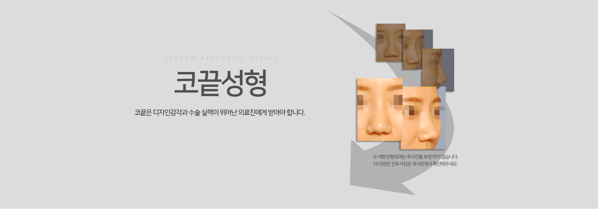 코끝성형 코끝은 디자인감각과 수술 실력이 뛰어난 의료진에게 받아야 합니다.