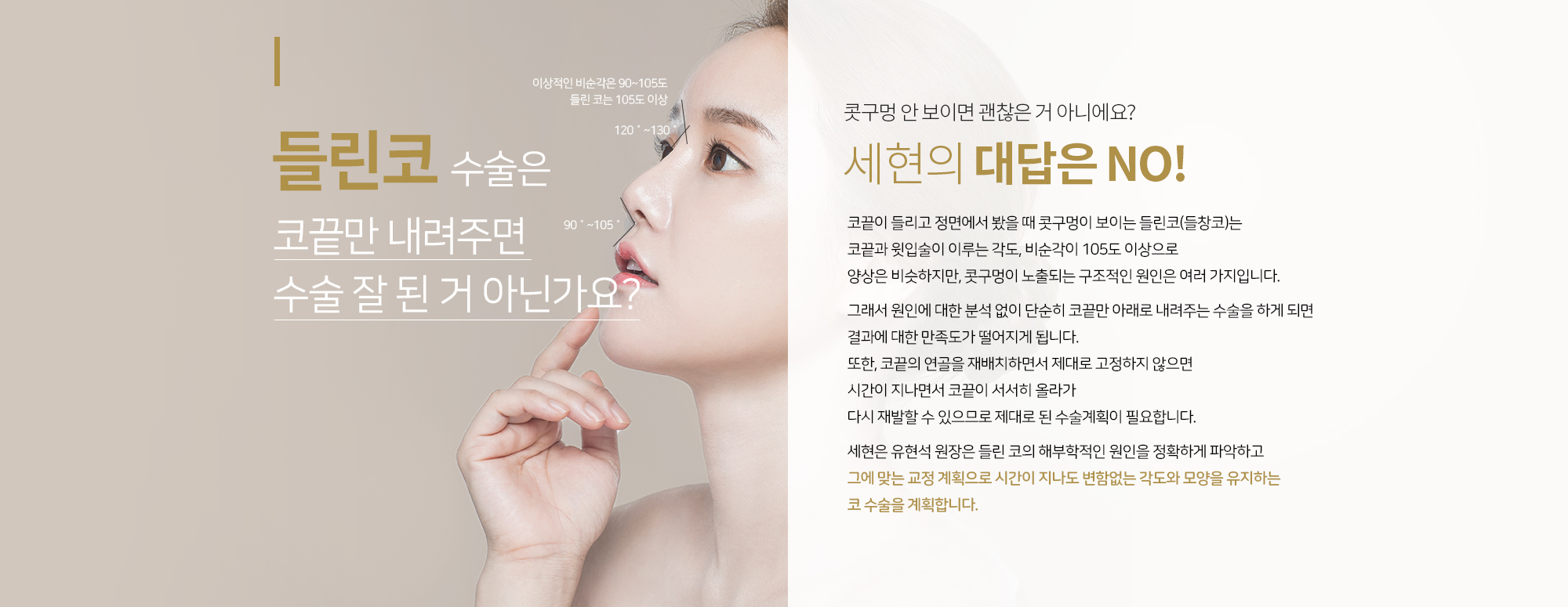 들린코(들창코) 수술은 
		코끝만 내려주면 수술 잘 된 거 아닌가요?
		콧구멍 안 보이면 괜찮은 거 아니에요?
		세현의 대답은 NO
		코끝이 들리고 정면에서 봤을 때 콧구멍이 보이는 들린코(들창코)는
		코끝과 윗입술이 이루는 각도, 비순각이 105도 이상으로
		양상은 비슷하지만, 콧구멍이 노출되는 구조적인 원인은 여러 가지입니다.

		그래서 원인에 대한 분석 없이 단순히 코끝만 아래로 내려주는 수술을 하게 되면 
		결과에 대한 만족도가 떨어지게 됩니다. 
		또한, 코끝의 연골을 재배치하면서 제대로 고정하지 않으면
		시간이 지나면서 코끝이 서서히 올라가 
		다시 재발할 수 있으므로 제대로 된 수술계획이 필요합니다.   

		세현은 유현석 원장은 들린 코의 해부학적인 원인을 정확하게 파악하고 
		그에 맞는 교정 계획으로 시간이 지나도 변함없는 각도와 모양을 유지하는 
		코 수술을 계획합니다.